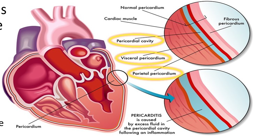 <p>Fibrous Pericardium - provides protection and anchors the heart in place</p><p>Serous Pericardium - provides lubricating fluid which collects in the pericardial cavity to reduce friction of the heart against other tissues</p><ul><li><p>Parietal Pericardium (superficial to the pericardial cavity)</p></li><li><p>Visceral Pericardium (deep to the pericardial cavity)</p></li></ul><p></p>