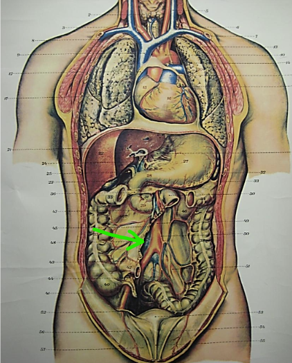 term image
