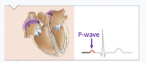 <p>action potential spreads through atria which depolarises</p>