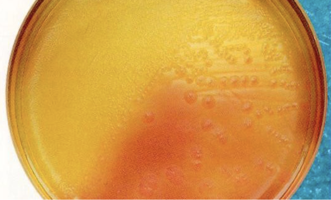 <p>what media for clostridium difficile has the following characteristics:</p><ul><li><p>yellow, ground glass colonies </p></li><li><p>smells like horse manure </p></li><li><p>fluoresces chartreuse (yellow green) when exposed to UV light</p></li></ul><p></p>