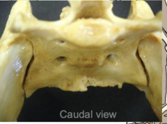 <p>what aspect of the sacroiliac joint is shown here</p>