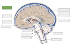 <p>This is the</p>