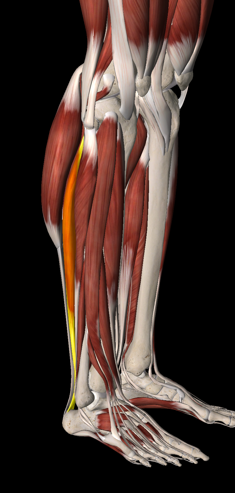<p>What muscle is this?</p>