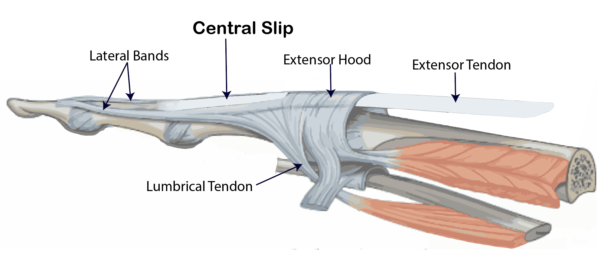 <p><strong>PIP Joint:</strong> Lateral Bands Function</p>