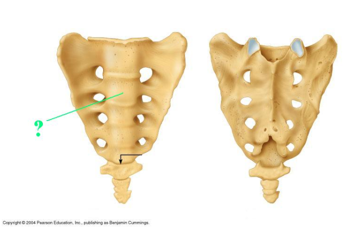 <p><span>Identify the indicated bone.</span></p>
