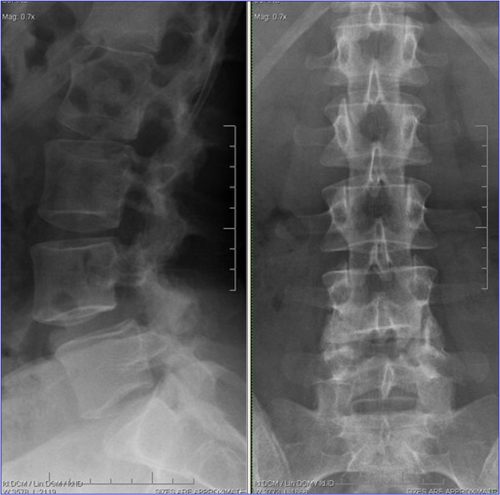 <p>What is the diagnosis?</p>