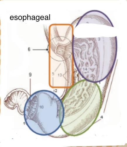 <ul><li><p>Not likely esophageal in origin (in spite of name)</p></li></ul><p></p>