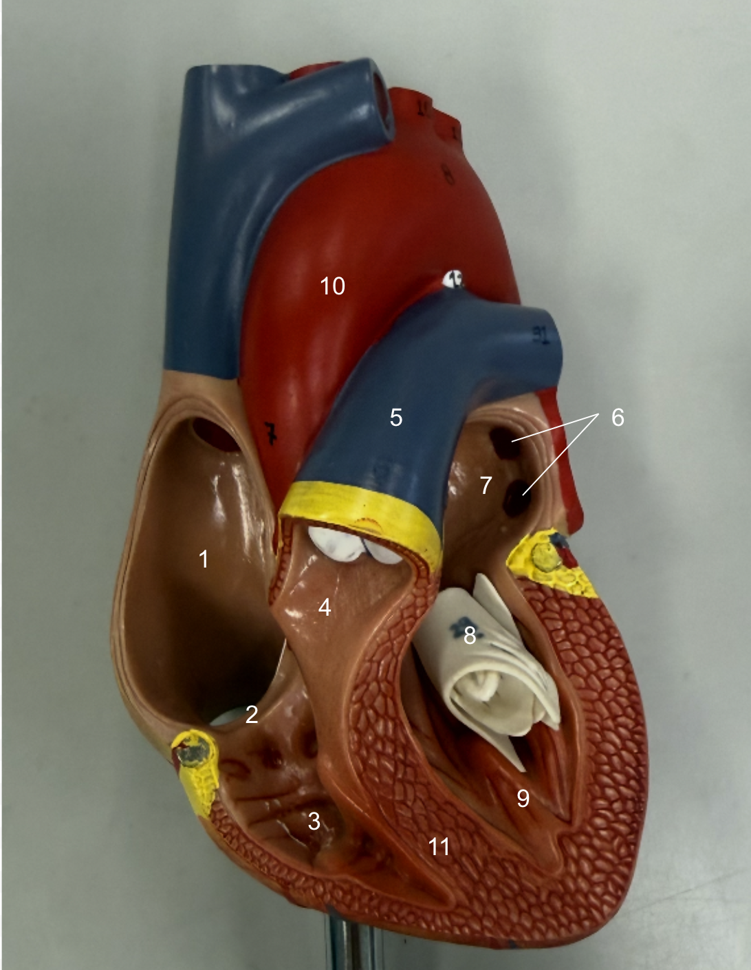 <p>What is structure 11?</p>