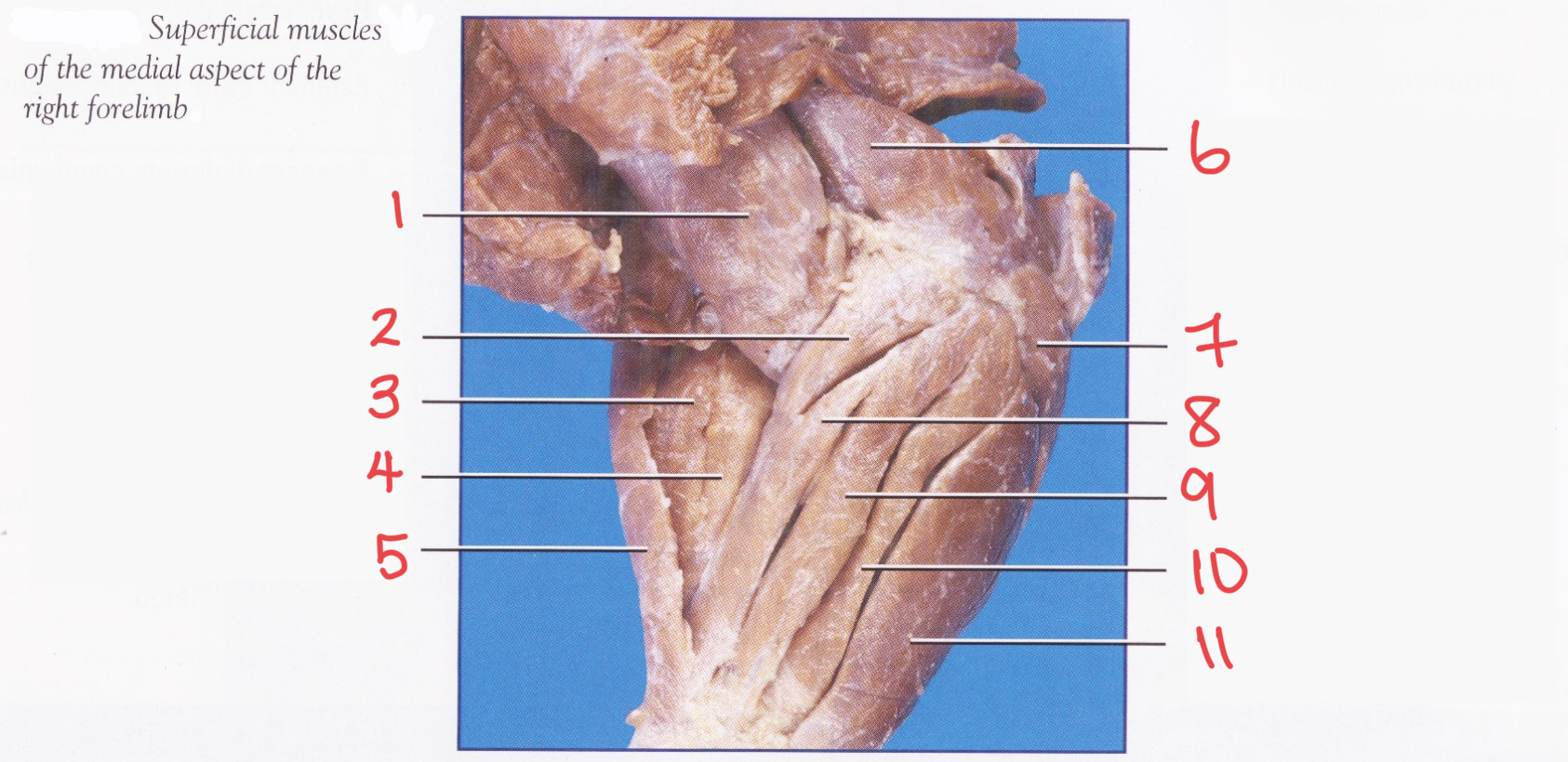 <p>Name muscle #1</p>