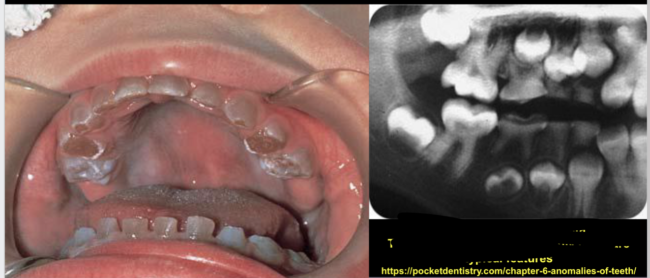 term image