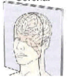 <p>slice orientation</p>