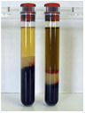 <p>the increased presence of bilirubin in the serum</p><p>causes a dark yellow coloration</p>