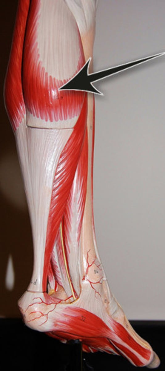 <p>Origin: medial and lateral condyle of femur</p><p>Insertion: calcaneus</p><p>Action: plantar flex</p>