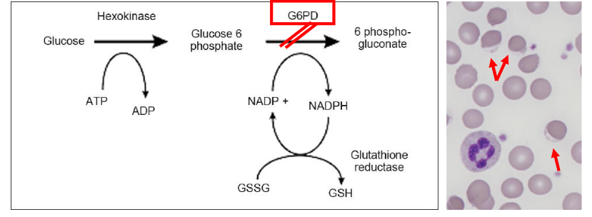 <p>Red Cell Enzyme Defects</p>