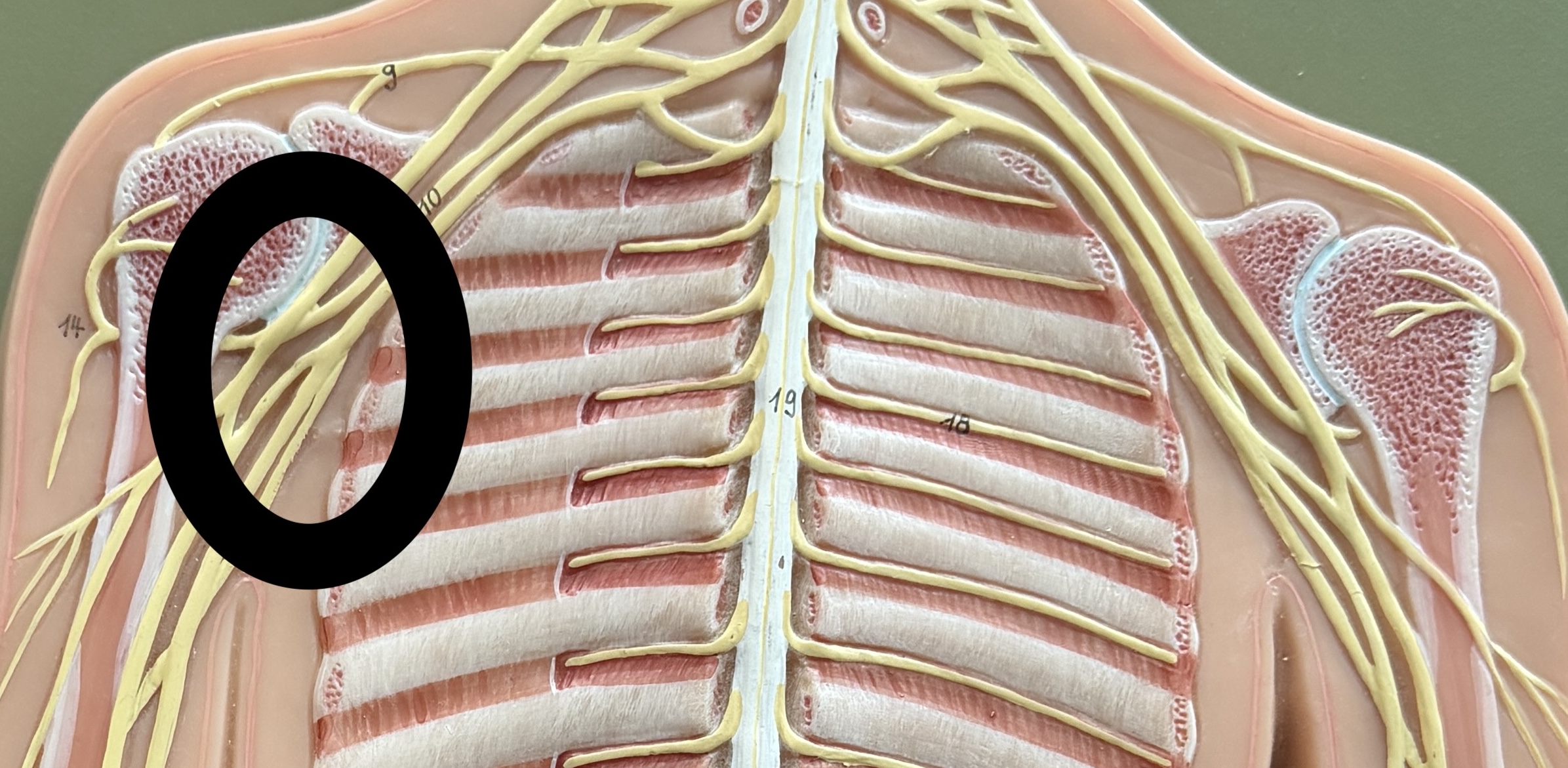 <p>wings in alt model</p><p>overlap</p><p></p>