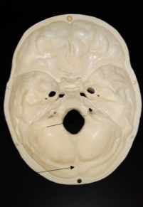 <p>What is this area (great big hole)?</p>