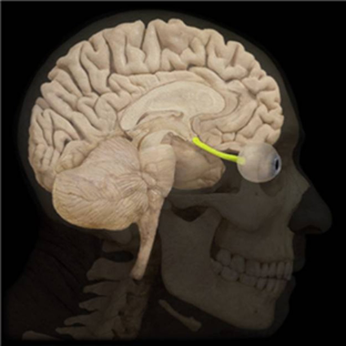 <p>Optic (vision)</p>