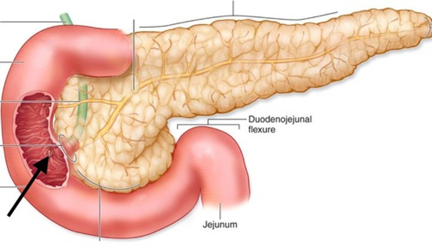<p>duodenal</p>