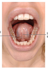 <p>What part of the tongue is the image showing?</p>