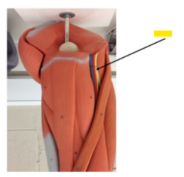 <p>What is the yellow arrow?</p>