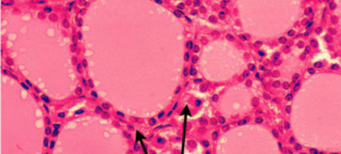 <p>What are the arrows pointing to?</p>