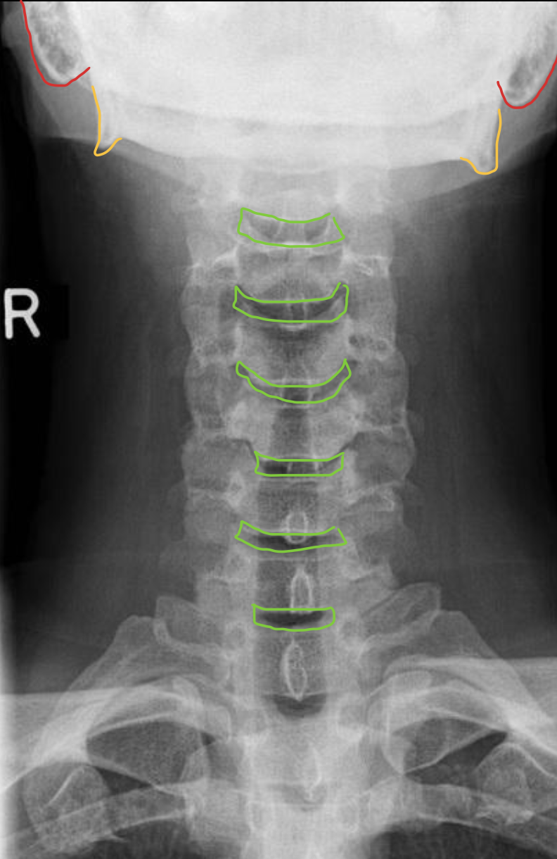 <p><span>椎间隙（Intervertebral Disc space）</span></p>