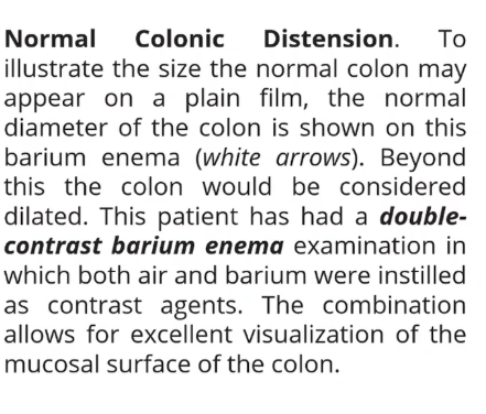 <p>Normal colonic distension</p>