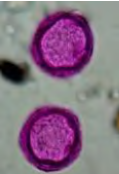 <p>What type of pollen? </p>