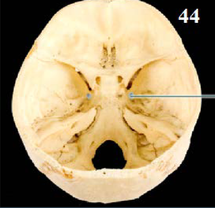 <p>Name this foramen and what runs through</p>