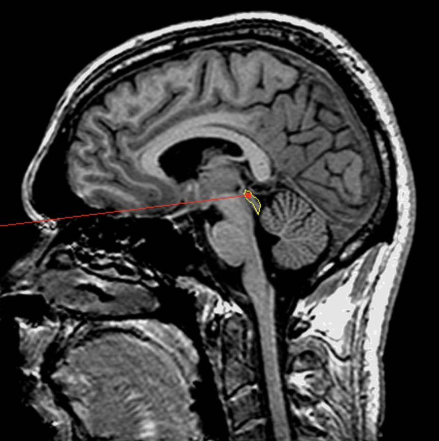<p>What is the area highlighted called?</p>