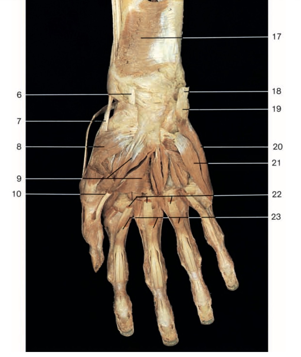 <p>Pinche 9</p>