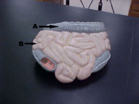 <p>B</p>