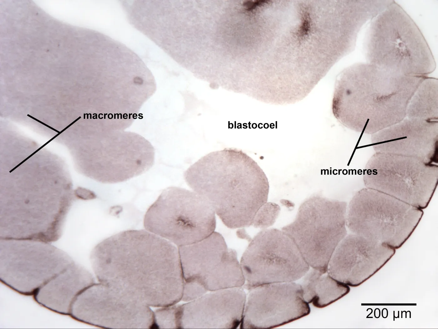 <p>late cleavage </p>