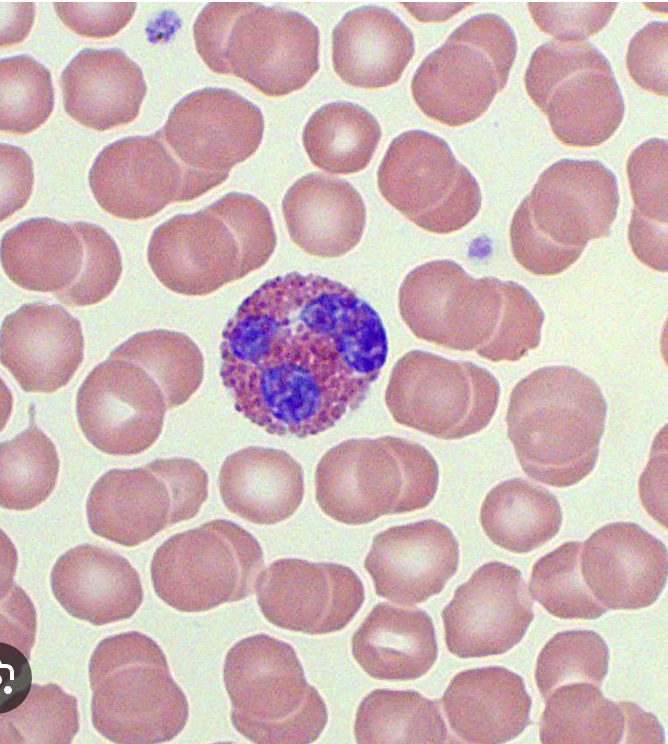 <p>Eosinophils increase in what conditions?</p>
