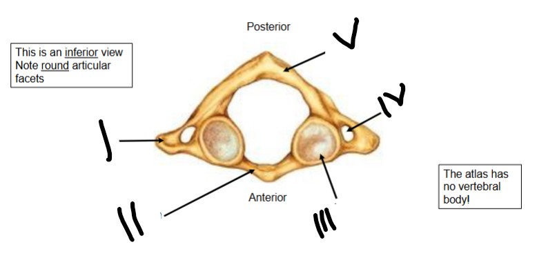 <p>What is II pointing at</p>