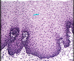 <p>Identify the highlighted structure</p>