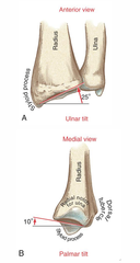 <p>Angled 25 degrees medial (ulnar tilt)</p><p>Angled 10 degrees palmar direction (palmar tilt)</p>