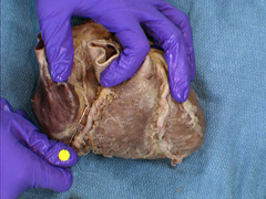 <p>identify the structure</p>