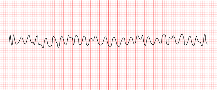 <p>what rhythm is this?</p>