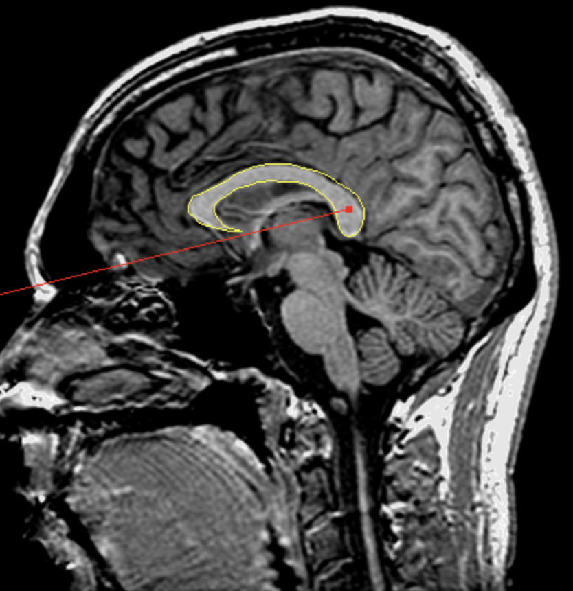 <p>What is the area highlighted called?</p>