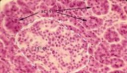 <p>extra pancreas histology</p>