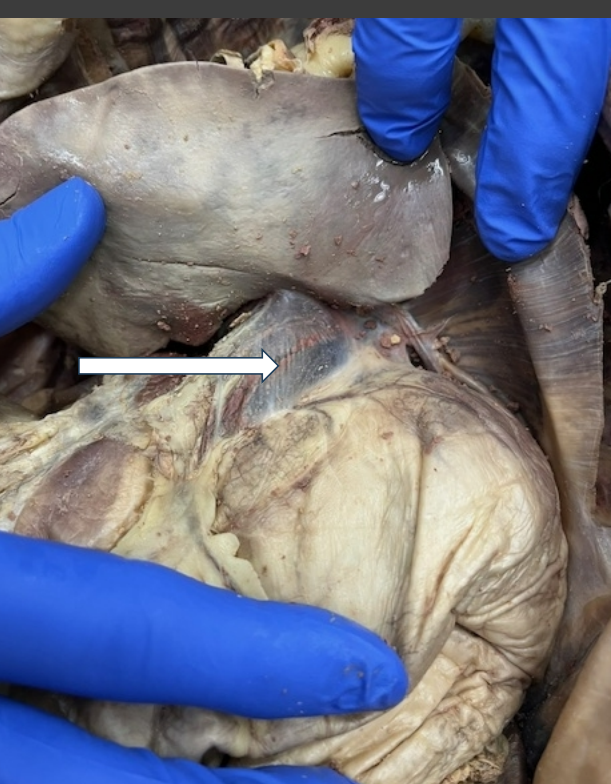 <p>What is the arrow pointing to?</p>