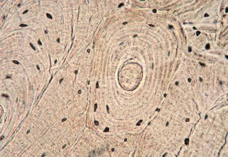 <p>forms the solid outer casing of bone</p>
