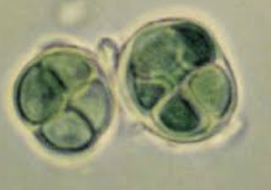 <p>a genus of coccoid, colonial cyanobacteria</p><ul><li><p>Concentric Sheaths (Gelatinous Envelopes)</p></li><li><p>Colonial Appearance</p></li><li><p>Cell Shape and Division: Cells are spherical, but appear hemispherical or irregular after division</p></li><li><p>Pigmented Sheaths: The envelopes are frequently colored</p></li></ul><p></p>
