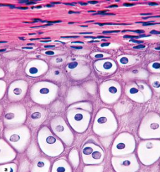 <p>What type of cartilage is this?</p>