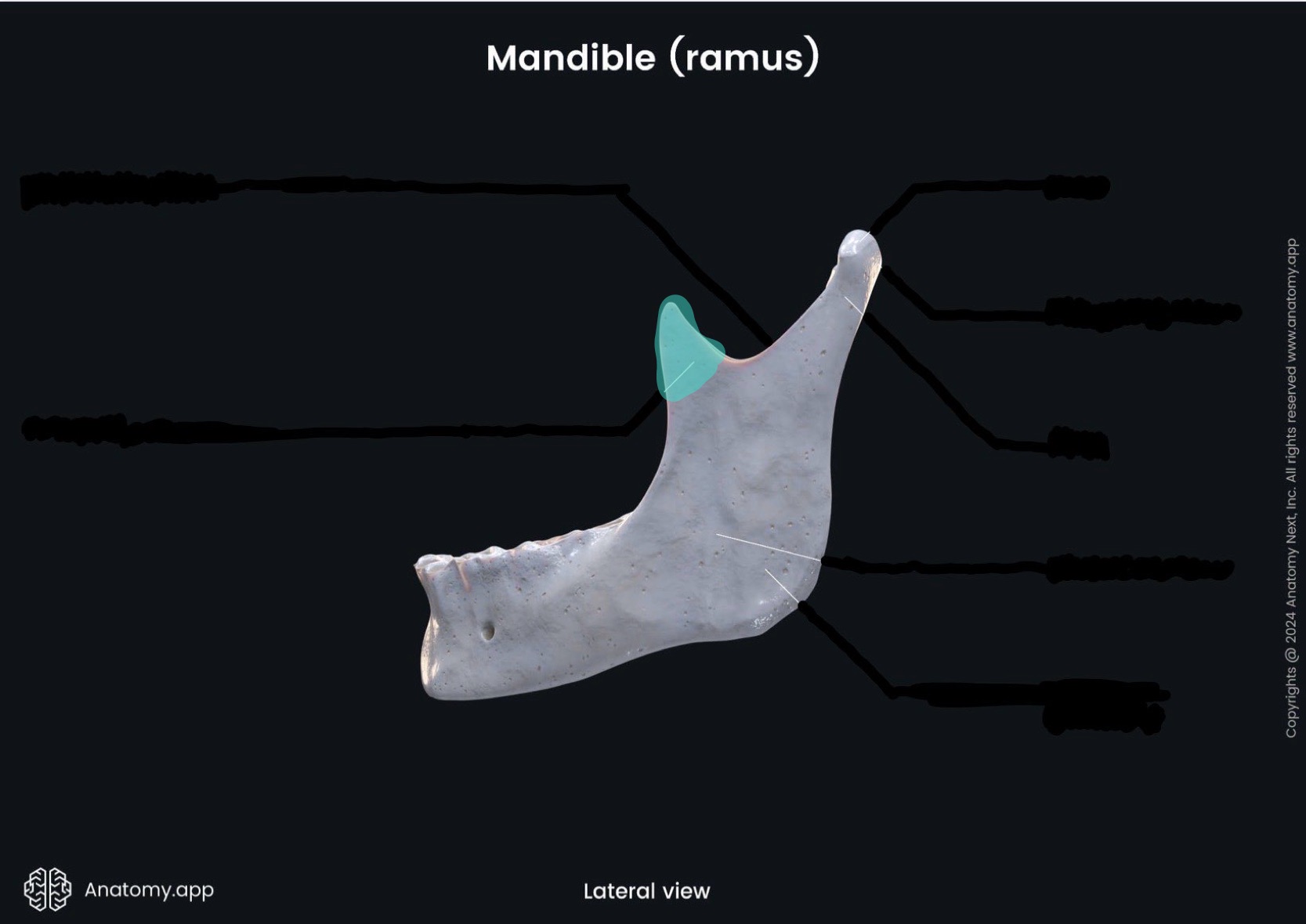 <p>What is the highlighted bony landmark</p>