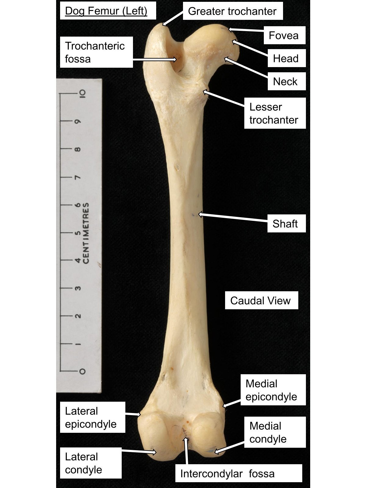 <p>Peak by the head of the femur</p>