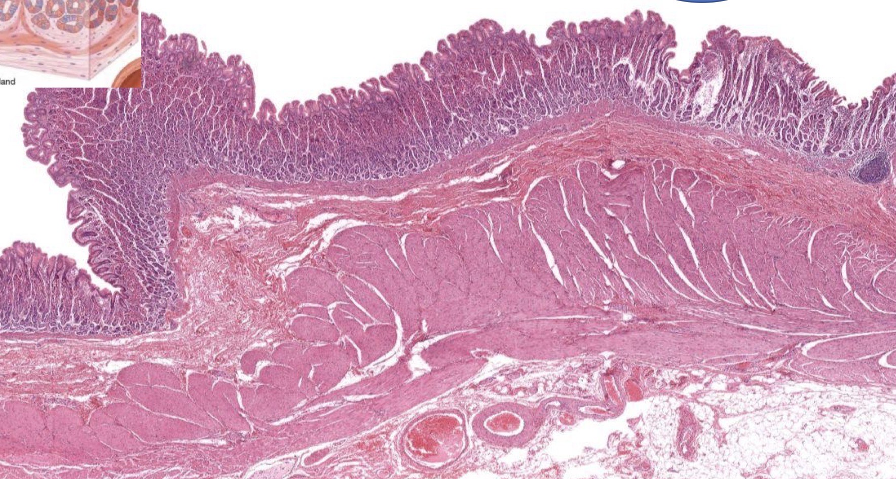 <p>Identify the Layers and Where?</p>