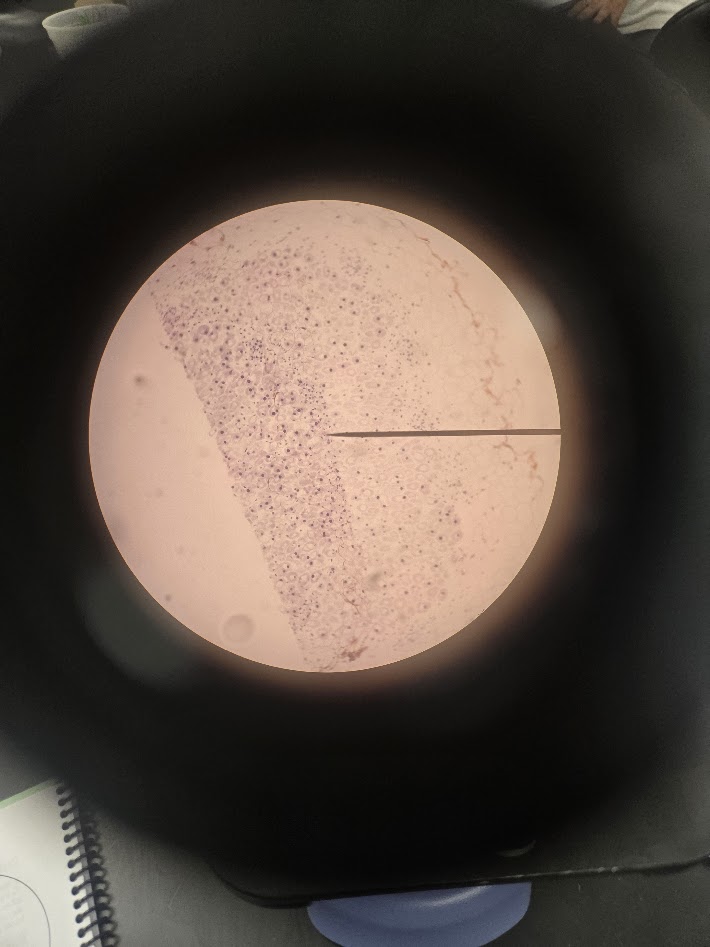 <ol><li><p>what phylum is this bacteria?</p></li><li><p>is it gram positive or gram negative?</p></li></ol><p></p>