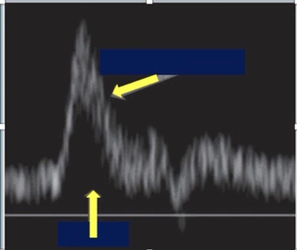 <p>True or false? The top arrow is pointing to the spectral envelope and the bottom arrow is pointing to the spectral window.</p>